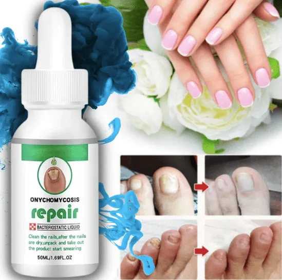 Kurizox™️ Nail Serum (Pack of 2)