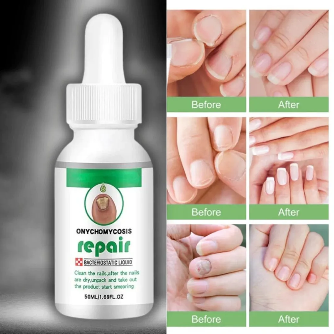 Kurizox™️ Nail Serum (Pack of 2)