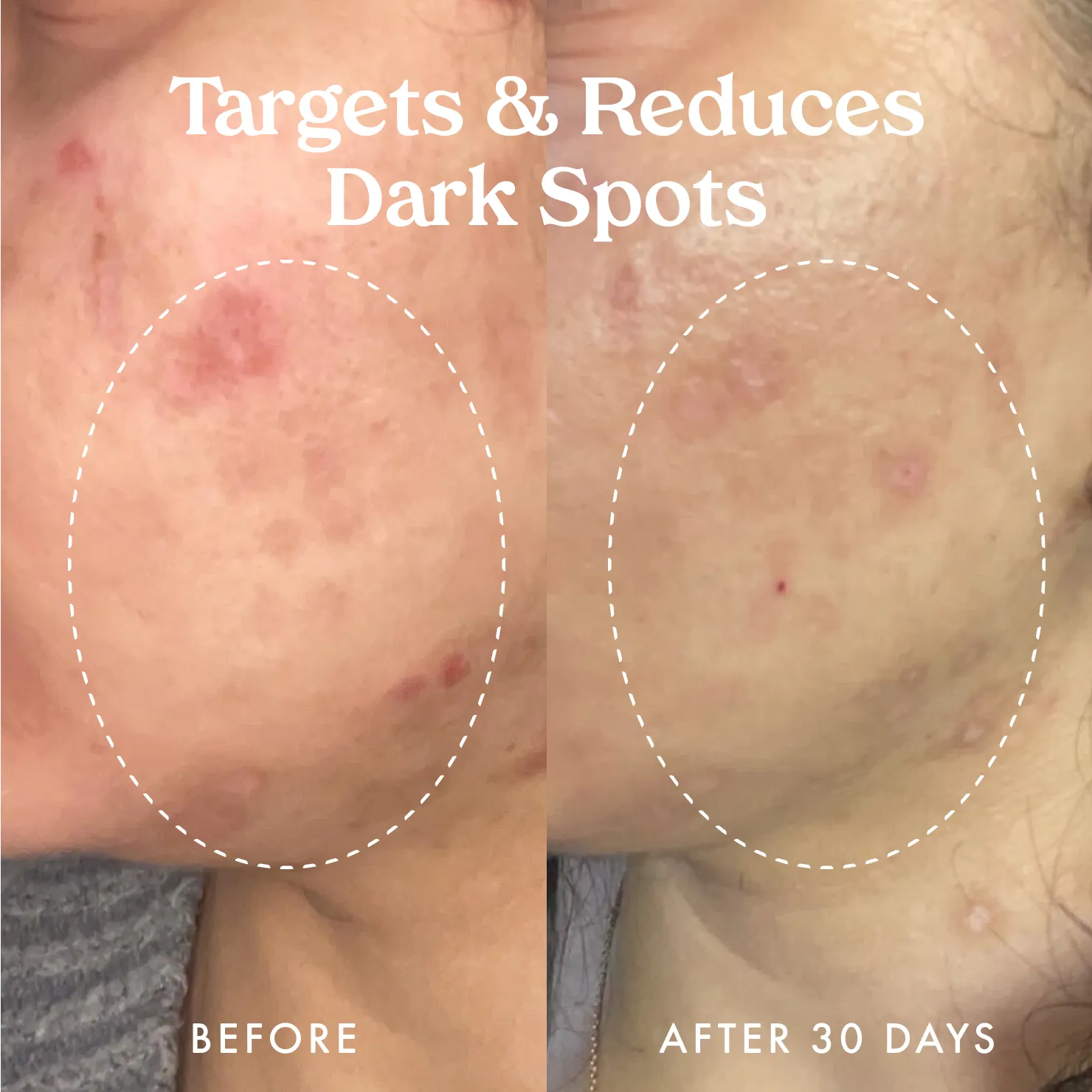 Star Bright Vitamin C Discoloration Correcting Serum